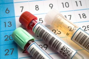 Ampullen mit Proben Ampullen mit Proben